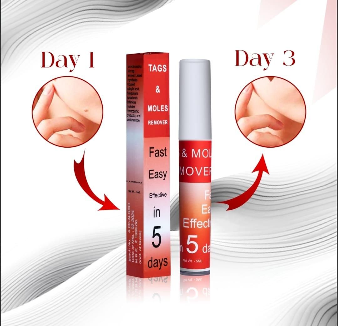 Tags & Moles Remover Gel✨