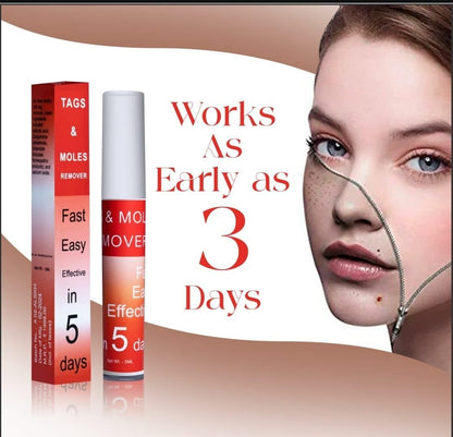 Tags & Moles Remover Gel✨